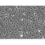 Human Hepatic Sinusoidal Endothelial Cells (HHSEC, Adult)